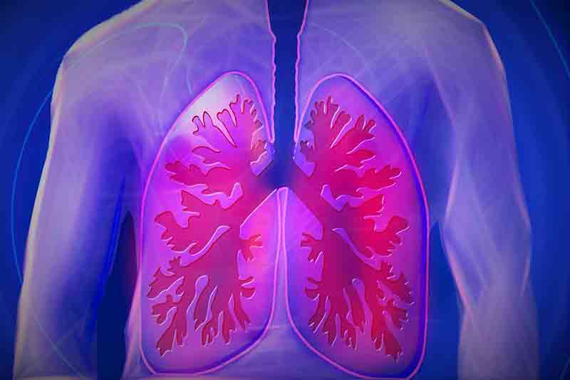 University of Melbourne develops web-based tool to improve treatment for drug-resistant TB